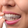 How Much Does Invisalign Clear Braces Cost?