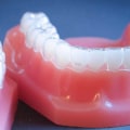 Can I Smoke While Wearing Invisalign Clear Braces?
