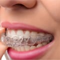 Can I Wear a Mouthguard with Invisalign Clear Braces?