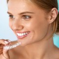 Invisible Orthodontics: Transforming Smiles With Invisalign Clear Braces In Woden