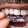 Maintaining Your Smile After Invisalign Clear Braces