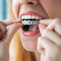 How Invisalign Clear Braces Can Improve Your Oral Health In Cedar Park, TX