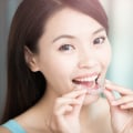 Achieve A Perfect Smile With Invisalign Clear Braces: Your Guide To Finding The Best Invisalign Dentist In Round Rock, TX