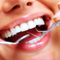 Transform Your Smile: Invisalign Clear Braces From A Trusted Dentist In Basel