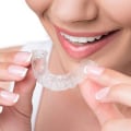 Embrace The Clear Path To A Beautiful Smile: Invisalign In Rockville, MD