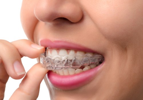 How Much Does Invisalign Clear Braces Cost?