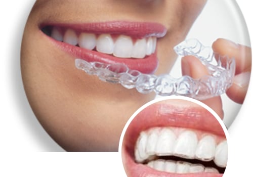 Straighten Your Smile with Invisalign in Yorktown Heights