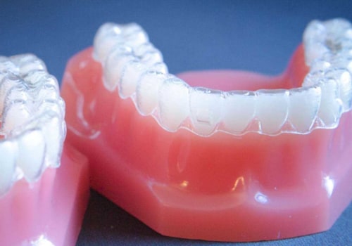 Can I Smoke While Wearing Invisalign Clear Braces?