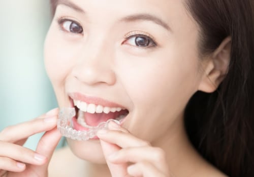 Brushing and Flossing with Invisalign Clear Braces: A Guide