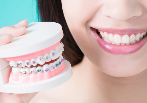 Affordable Alternatives to Invisalign Clear Braces