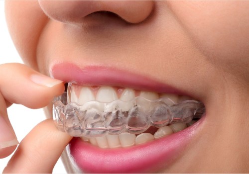 Can I Wear a Mouthguard with Invisalign Clear Braces?