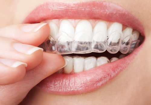 What Are the Risks of Invisalign Clear Braces?