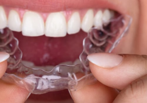 A Clear Choice For Straighter Teeth: Invisalign Clear Braces In Austin