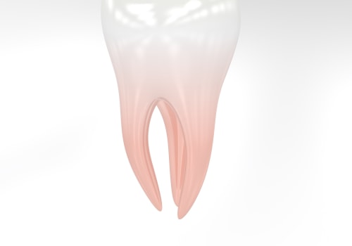 Achieve a Straighter Smile with Invisalign in Zurich