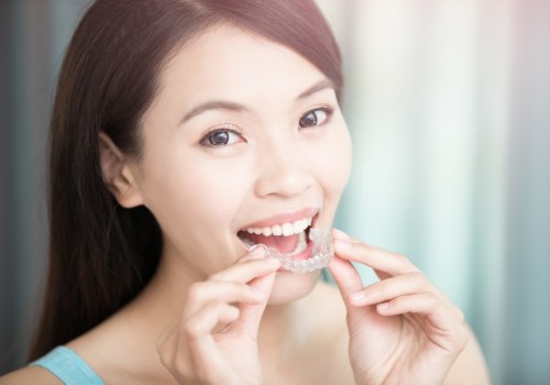 Achieve A Perfect Smile With Invisalign Clear Braces: Your Guide To Finding The Best Invisalign Dentist In Round Rock, TX
