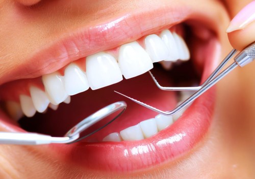 Transform Your Smile: Invisalign Clear Braces From A Trusted Dentist In Basel