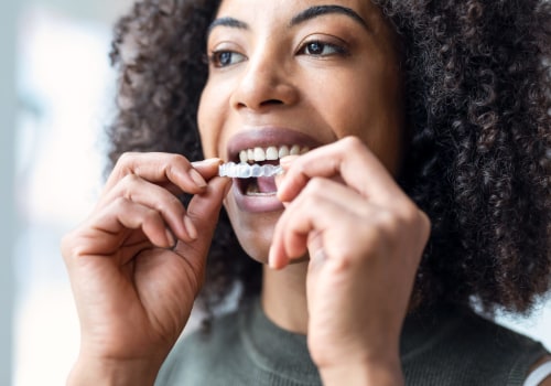 The Benefits of Invisalign Clear Braces in Contemporary Dentistry