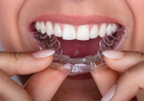 Can I Eat and Drink with My Invisalign Clear Braces?